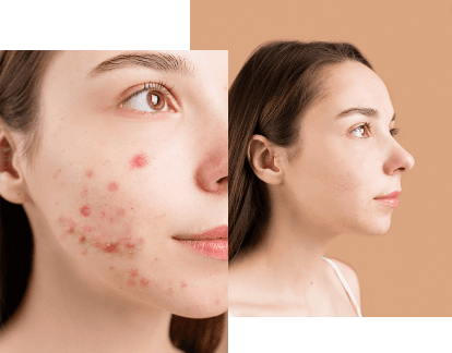 Patient managing skincare routine online with  FitRx